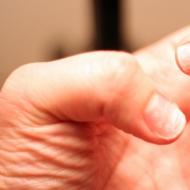Psoriazisul unghiilor: manifestări ale bolii și tratament